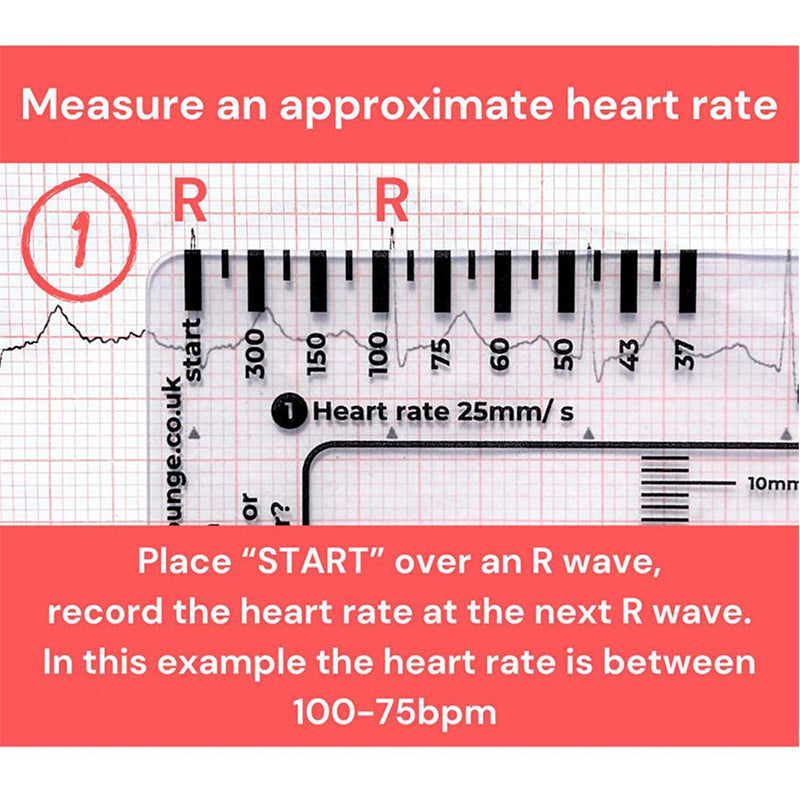 ECG 7 Step Ruler