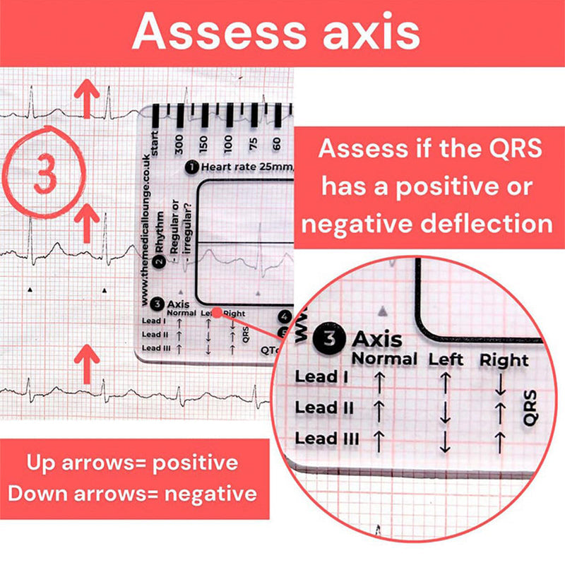 ECG 7 Step Ruler